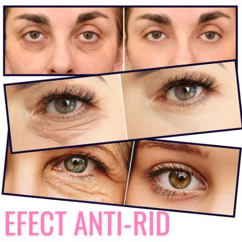 Crema Anti-Rid pentru Ochi Magic EYELIFT™