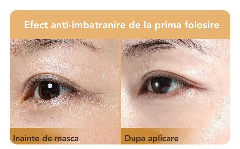 Set 10 Masti cu Collagen SKIN Sadoer™