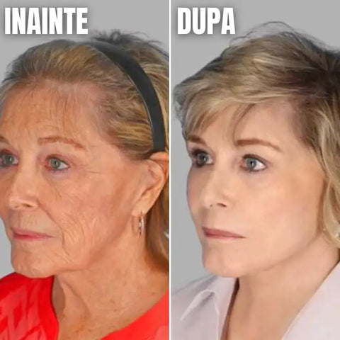 Ser Anti-Imbatranire cu Acid Hialuronic Matrixyl Collagen BOOST™