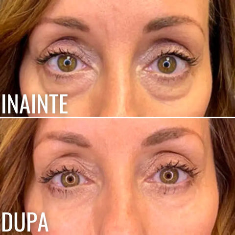Crema Anti-Rid pentru Ochi Magic EYELIFT™