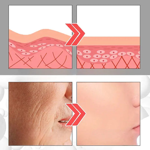 Ser Anti-Imbatranire cu Acid Hialuronic Matrixyl Collagen BOOST™