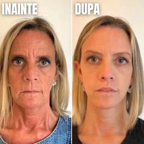 Ser Anti-Imbatranire cu Acid Hialuronic Matrixyl Collagen BOOST™