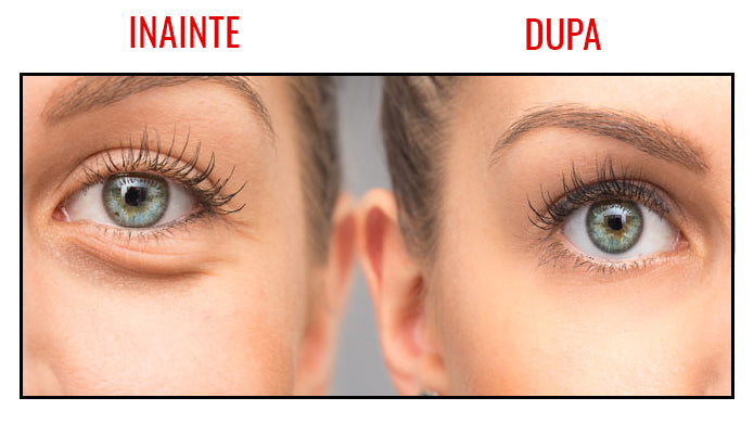 Crema Antirid Contur Ochi Vibrant Glamour