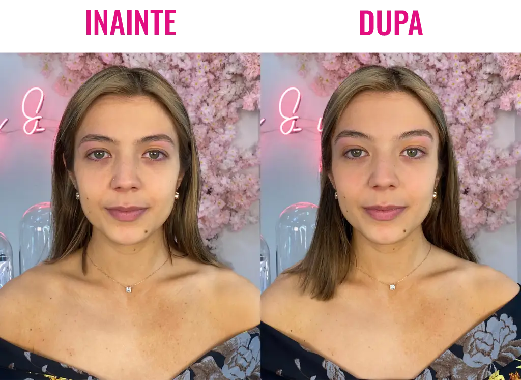 Set 40 Benzi Faciale Secret Lift Original ™