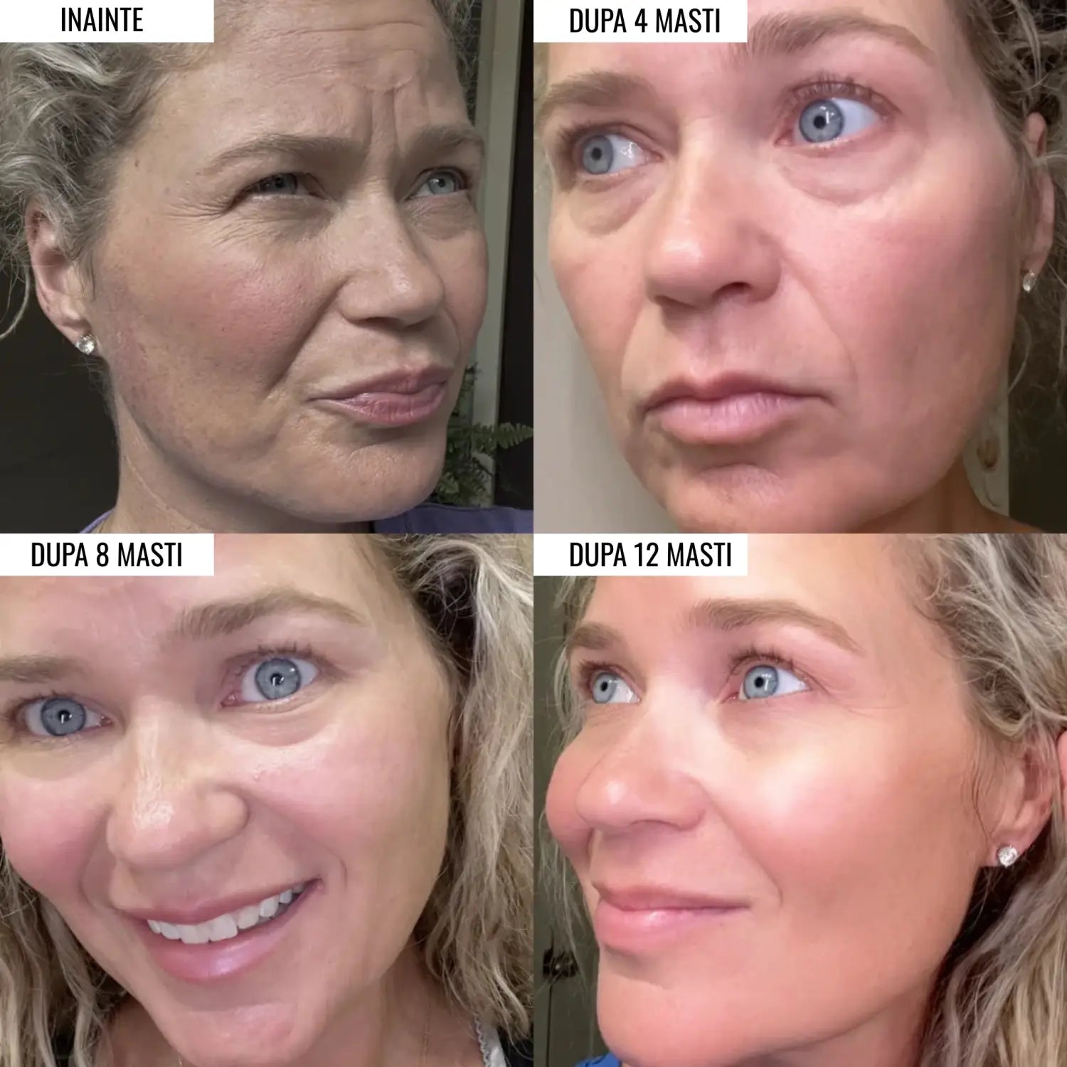 Set 4 Masti Retinol si Collagen Lifting Boost UP Face™