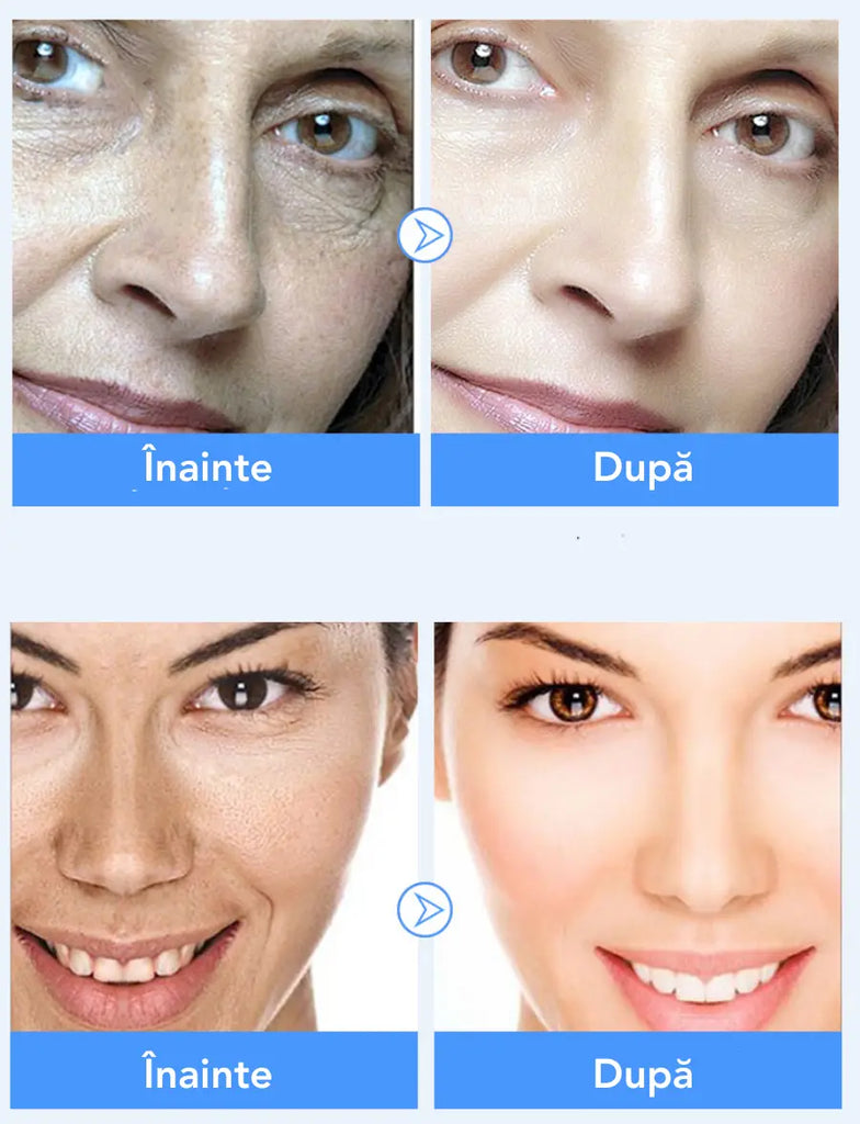 Crema Hidratanta Antirid cu Acid Hialuronic SkinSupreme™