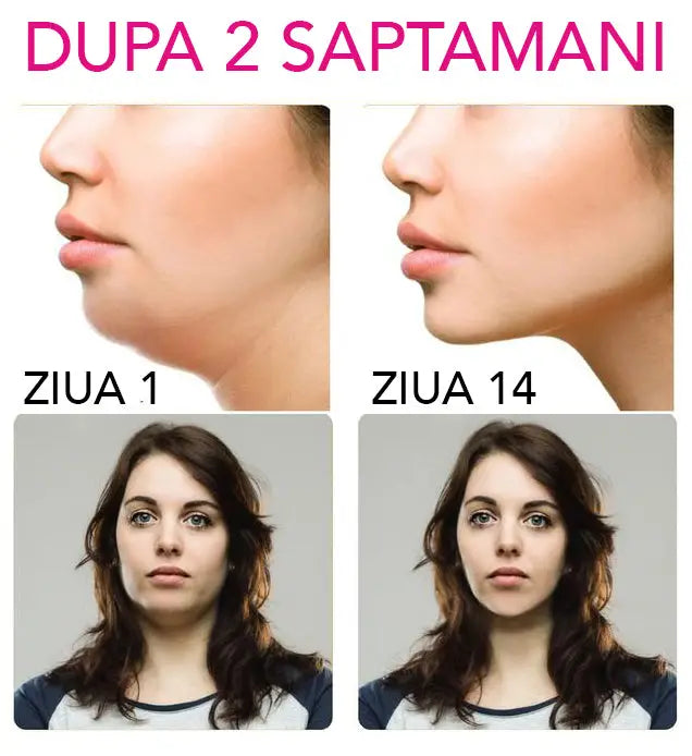 Masca Lifting Facial V-Shape Beauty