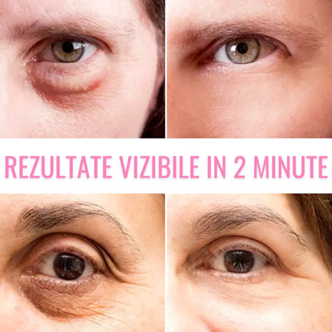 Crema Anti-Rid pentru Ochi Magic EYELIFT™