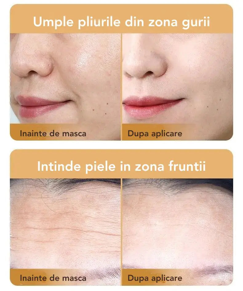 Set 10 Masti cu Collagen SKIN Sadoer™