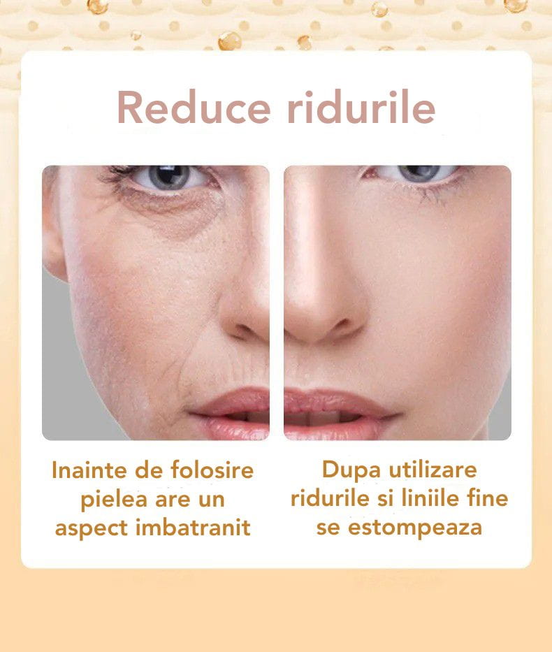 Set 10 Masti cu Collagen SKIN Sadoer™