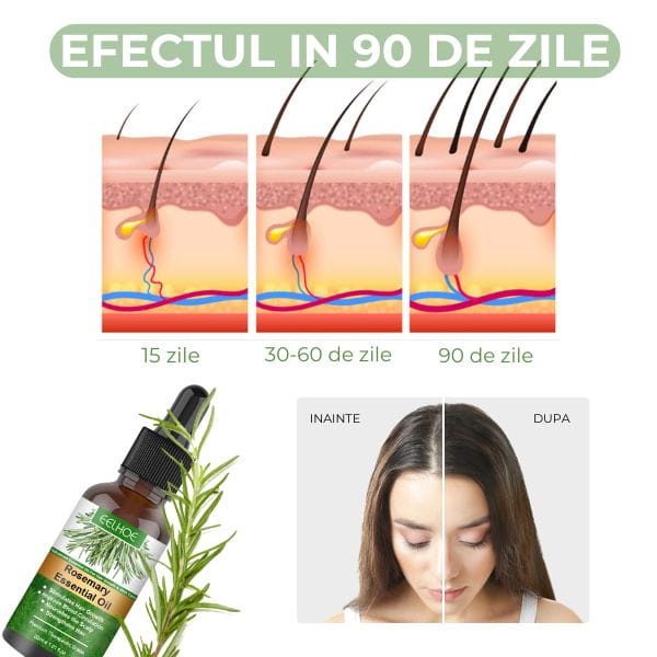 Ulei de Rozmarin pentru Cresterea Parului ESENHAIR