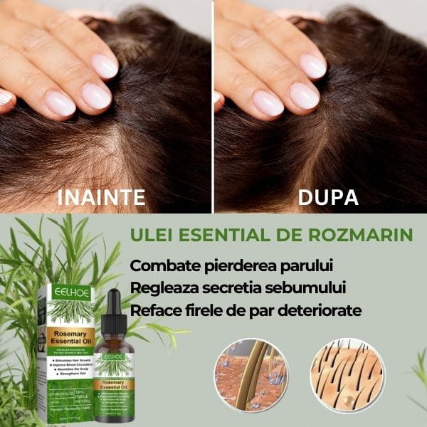 Ulei de Rozmarin pentru Cresterea Parului ESENHAIR