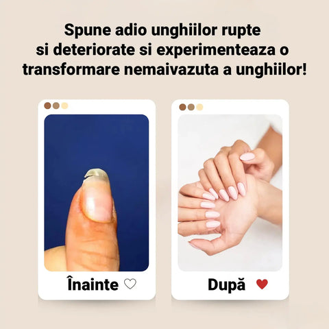 Gel Reparator Unghii + Lampa UV + Pensula FULLFIX ™