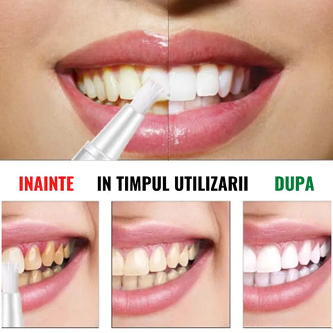 Stilou pentru Albirea Dintilor EFERO Mr. White