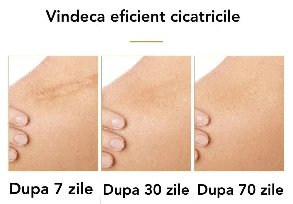 Crema pentru Acnee si Cicatrici LANBENA PRO™