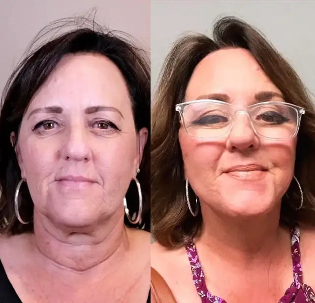 Crema Antirid pentru Gat si Decolteu NECKLIFT™