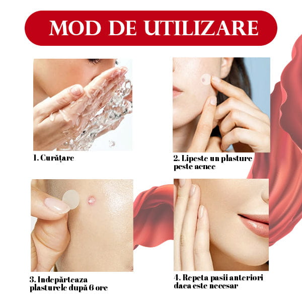 Set 144 Plasturi pentru Acnee HYDROSKIN™