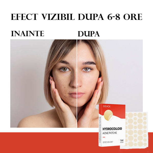 Set 144 Plasturi pentru Acnee HYDROSKIN™
