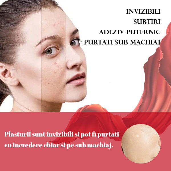 Set 144 Plasturi pentru Acnee HYDROSKIN™