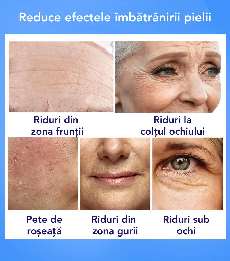 Crema Hidratanta Antirid cu Acid Hialuronic SkinSupreme™