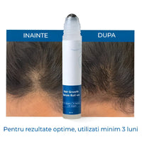 Ser Regenerator pentru Cresterea Parului & AntiCadere Rapid Growth™