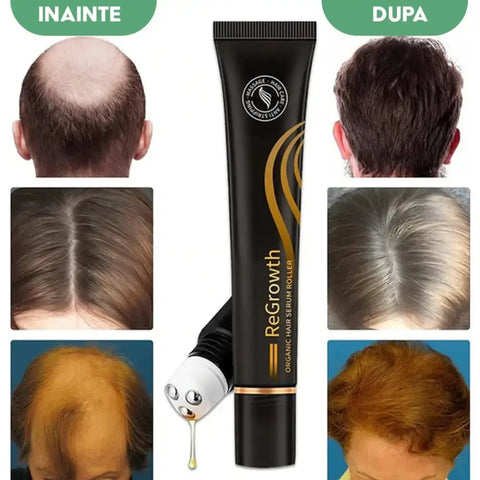 Ser Regenerator pentru Cresterea Parului ReGrowth ™