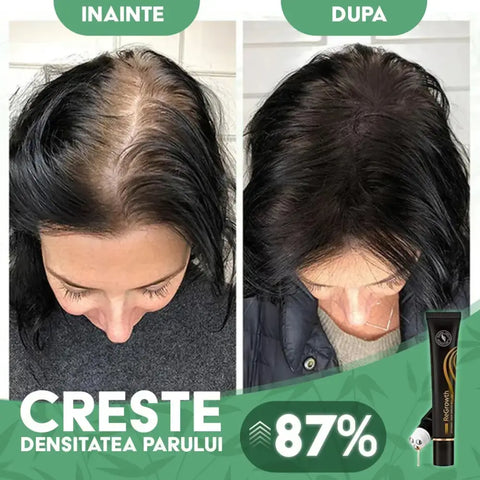 Ser Regenerator pentru Cresterea Parului ReGrowth ™