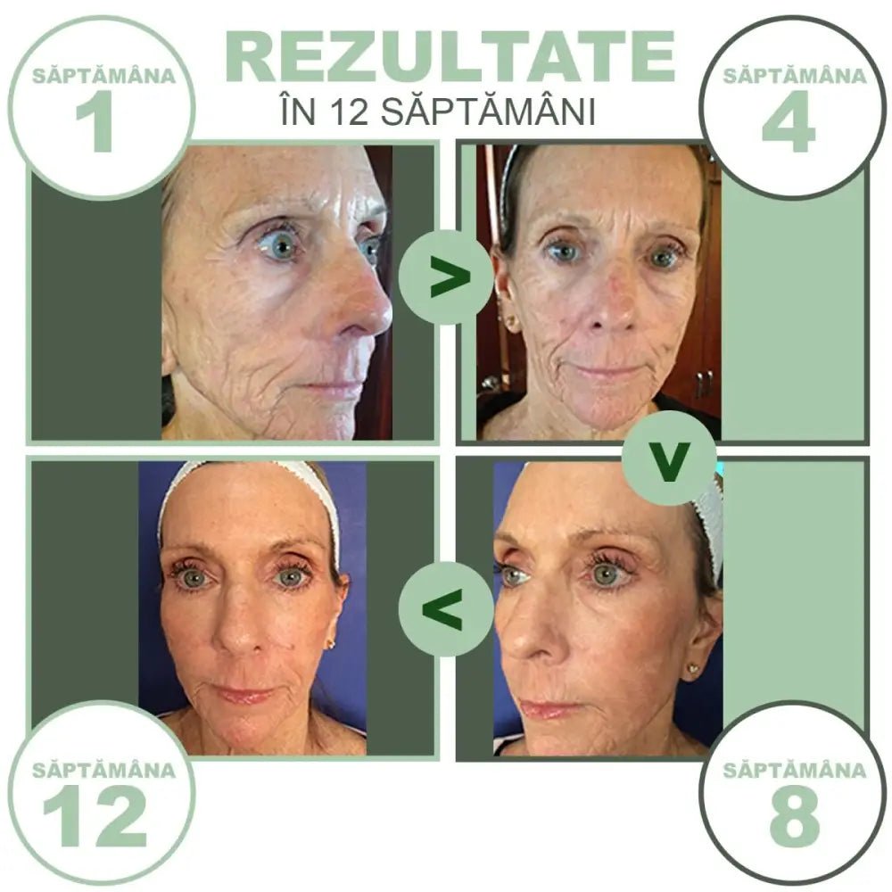 Set 20 Masti Faciale cu Colagen PURIME ™
