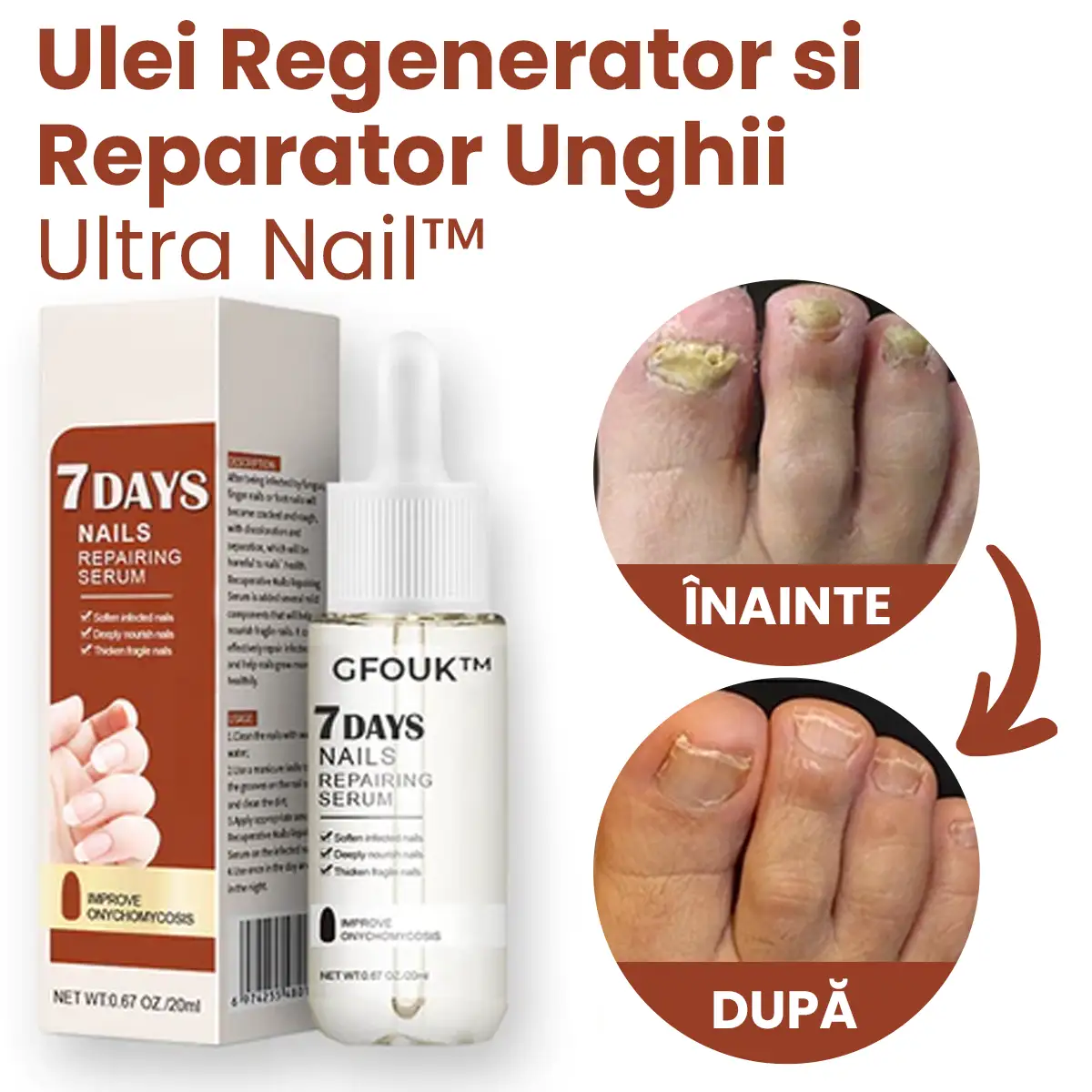 Ulei Regenerator si Reparator Unghii Ultra Nail™