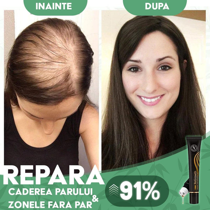 Ser Regenerator pentru Cresterea Parului ReGrowth ™