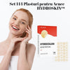 Set 144 Plasturi pentru Acnee HYDROSKIN™
